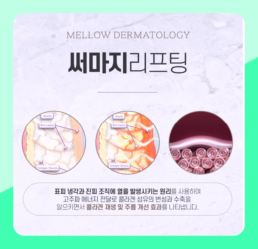 마포 울쎄라, 써마지 리프팅은 왜 표면을 차갑게 유지하나요? 멜로우피부과 공덕점